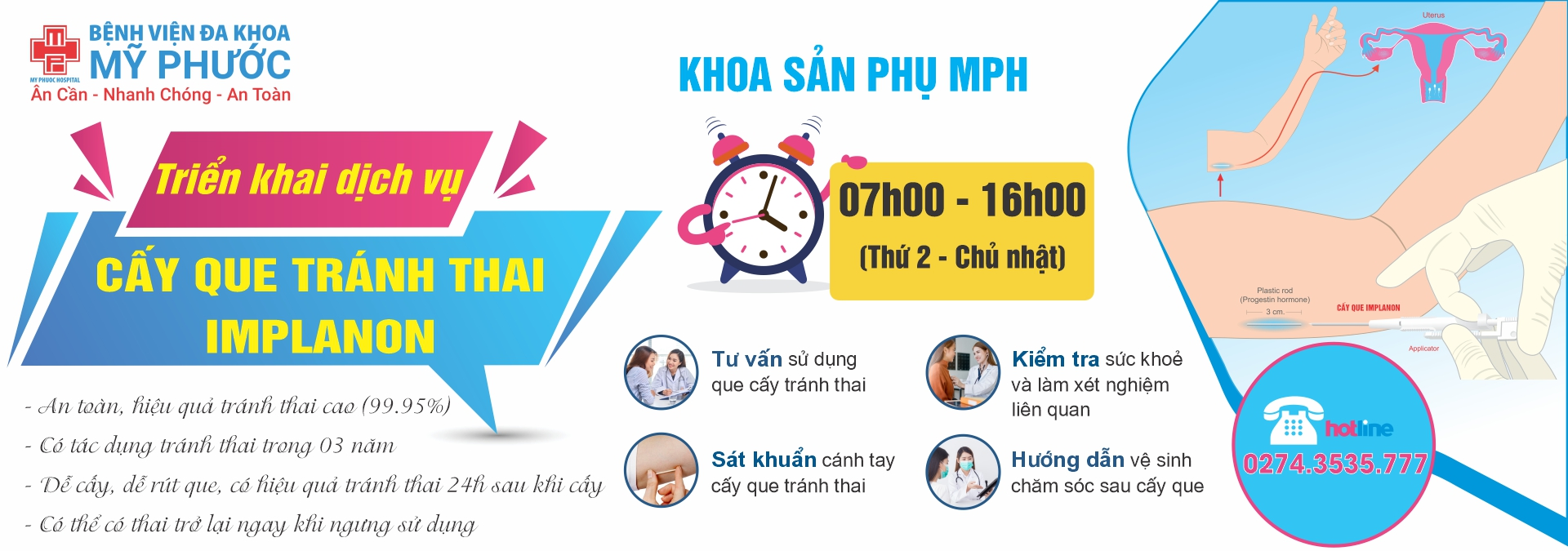 Triển khai dịch vụ cấy que tránh thai Implanon