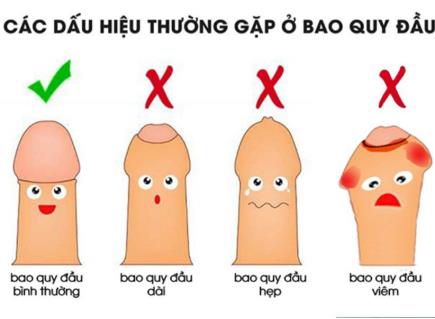 Bệnh viện có thực hiện cắt da bao quy đầu không? Thời gian nằm viện bao lâu thì được về?