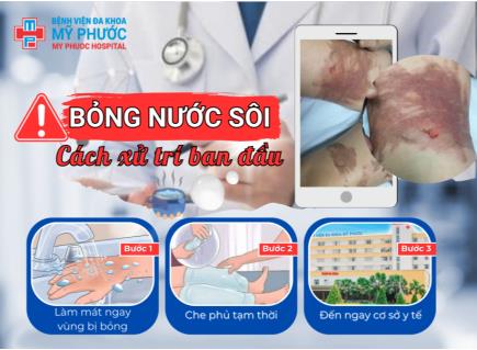 BỎNG NƯỚC SÔI – XỬ TRÍ ĐÚNG GIÚP GIẢM ĐAU & HẠN CHẾ SẸO