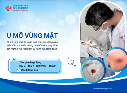 LOẠI  BỎ U MỠ VÙNG HÀM MẶT - ĐƠN GIẢN, AN TOÀN, TRIỆT ĐỂ VÀ ĐẢM BẢO THẨM MỸ TẠI MPH